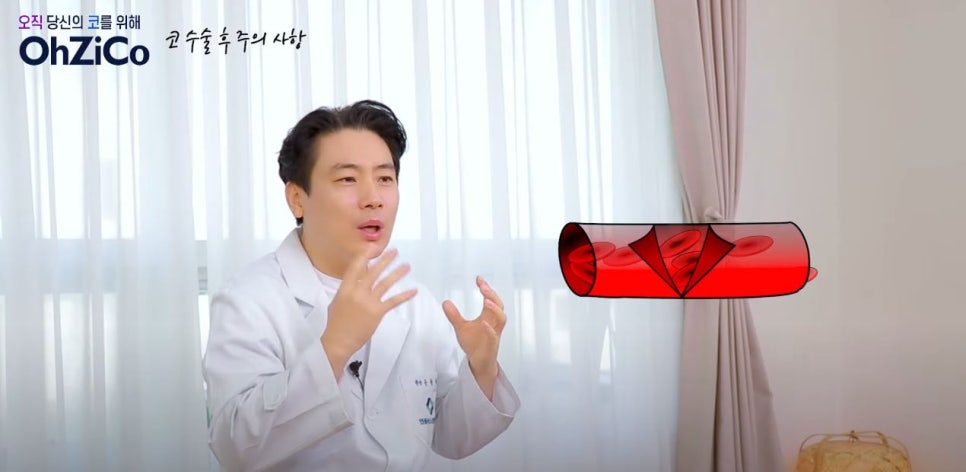 앤플러스에서 전달드리는 코성형주의사항 관련 이미지 4