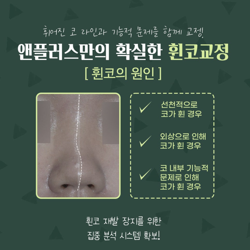 A Thorough Analysis for Reliable Crooked Nose Correction Reviews image 4