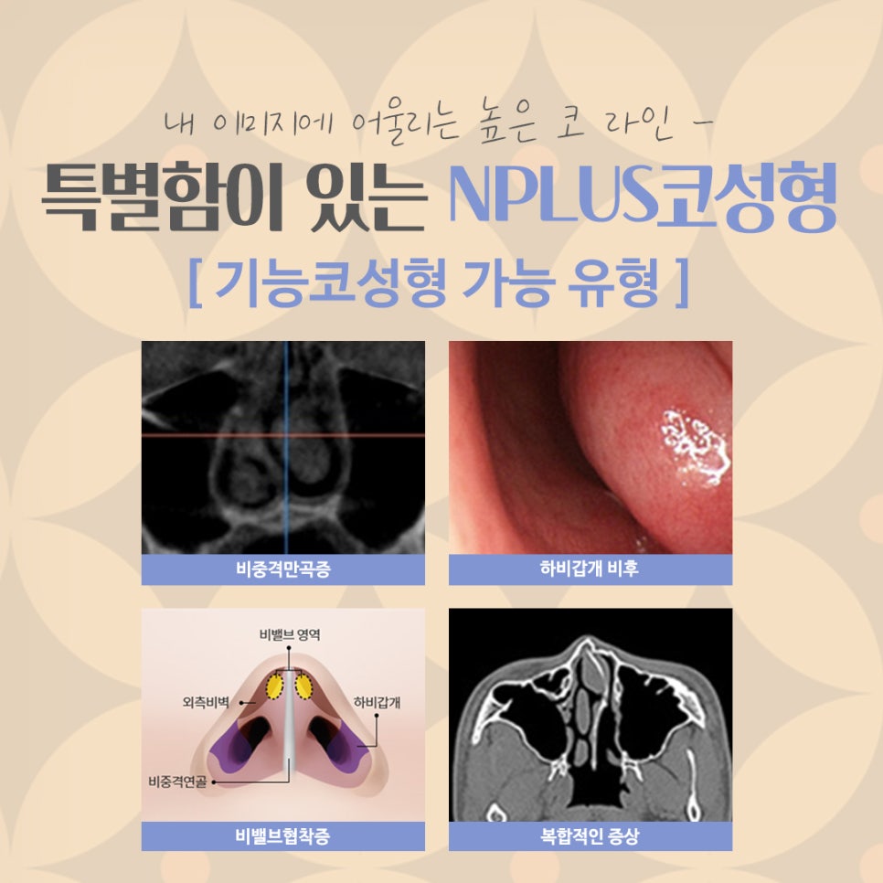 코성형후기 내부 기능까지 확실하게 관련 이미지 5