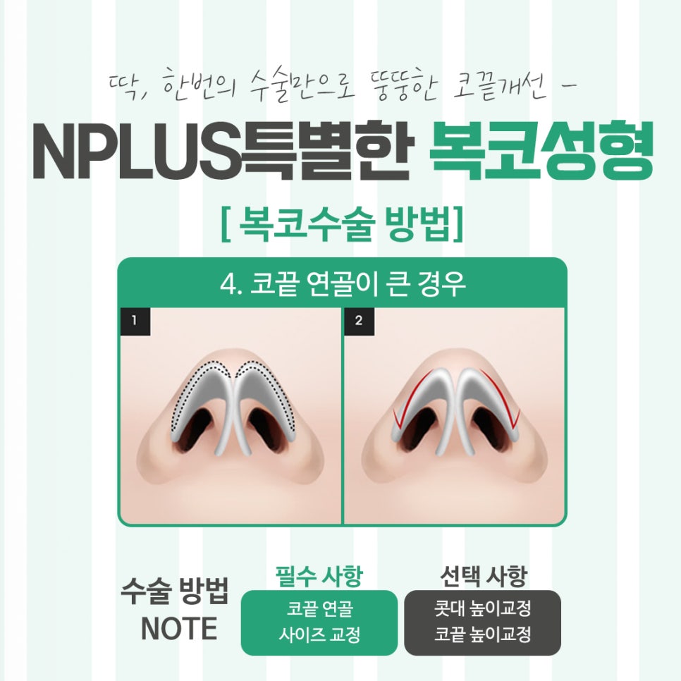 Looking Into Bulbous Nose Surgery Reviews to Improve Your Appearance image 10
