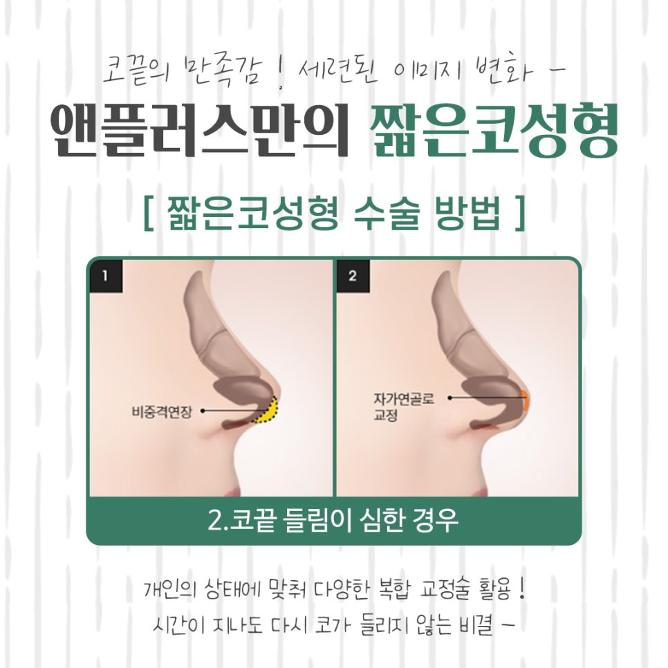 들린코수술후기 기능까지 확인하고 관련 이미지 11