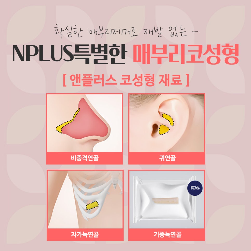 매부리코수술후기 자세하게 알아봐야 관련 이미지 12