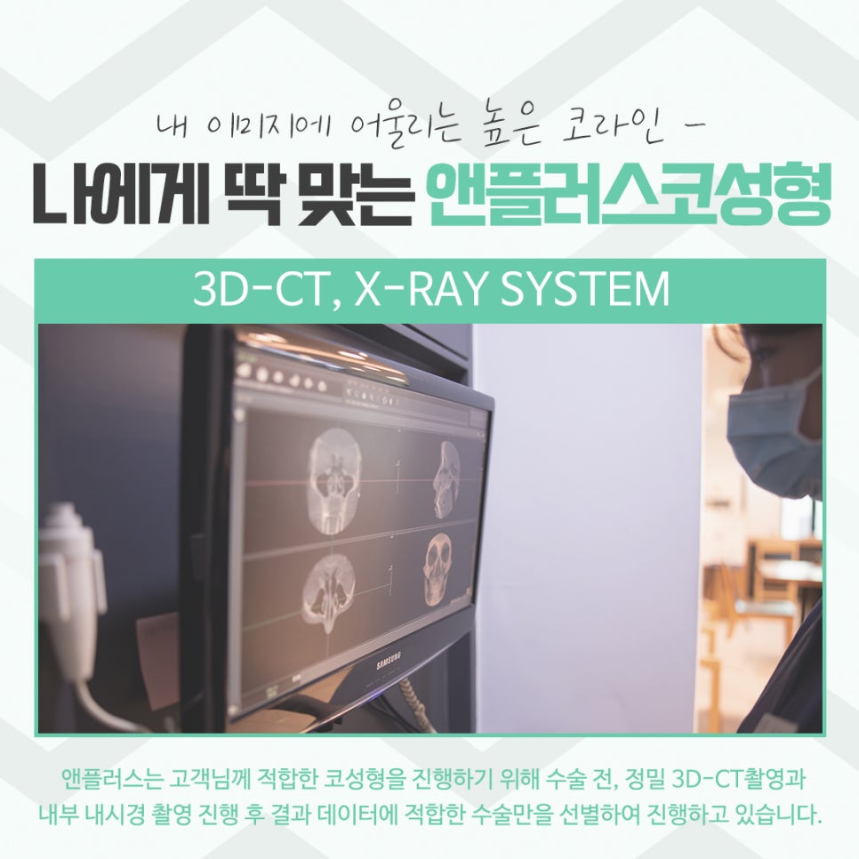 코성형후기 자연스러운 코라인으로 관련 이미지 7