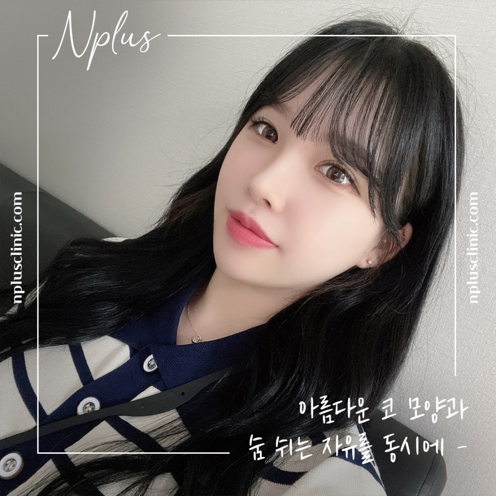 자가늑연골코성형으로 자연스럽지만 화려한 코 라인! 관련 이미지 1