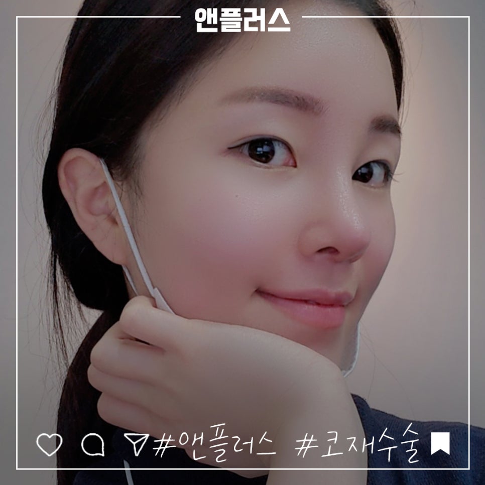 압구정성형외과에서 알아보는 코재수술후기 관련 이미지 2