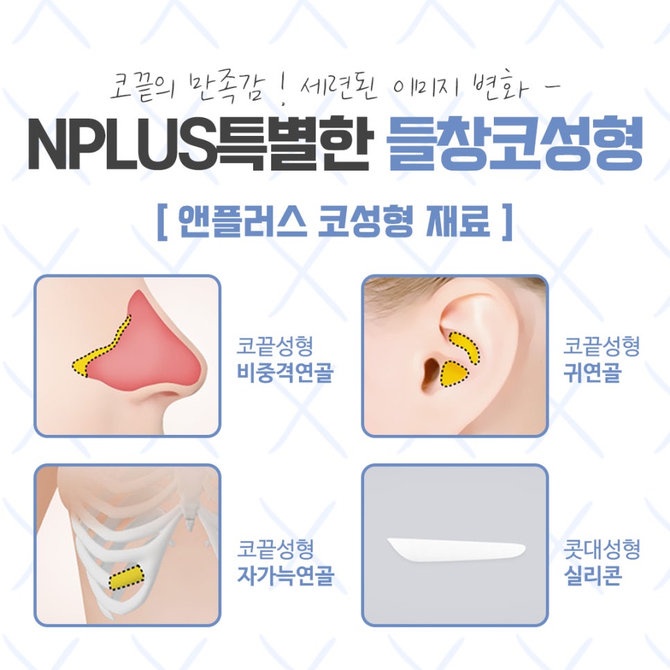 Upturned Nose Surgery for a Harmonious Look image 11