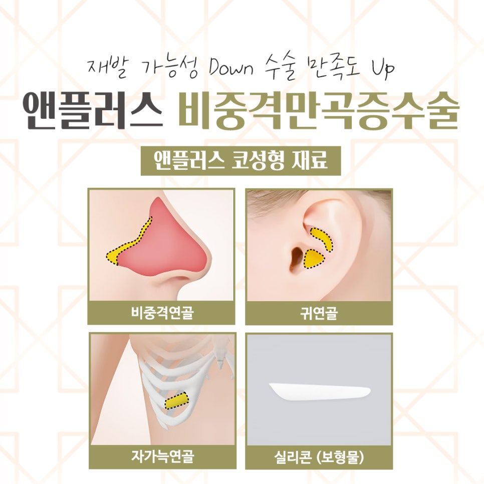 Septoplasty Surgery Review: Accurately Identifying the Cause image 11