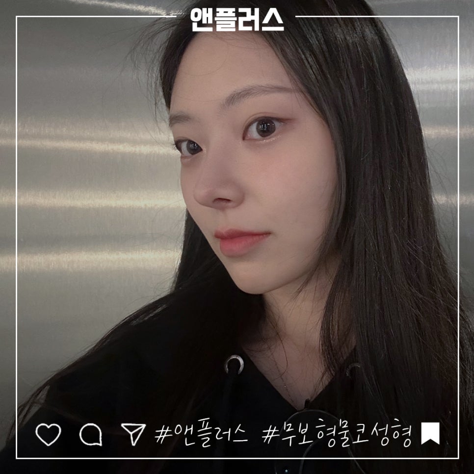 무보형물코성형후기 만족스러운 라인으로 관련 이미지 3