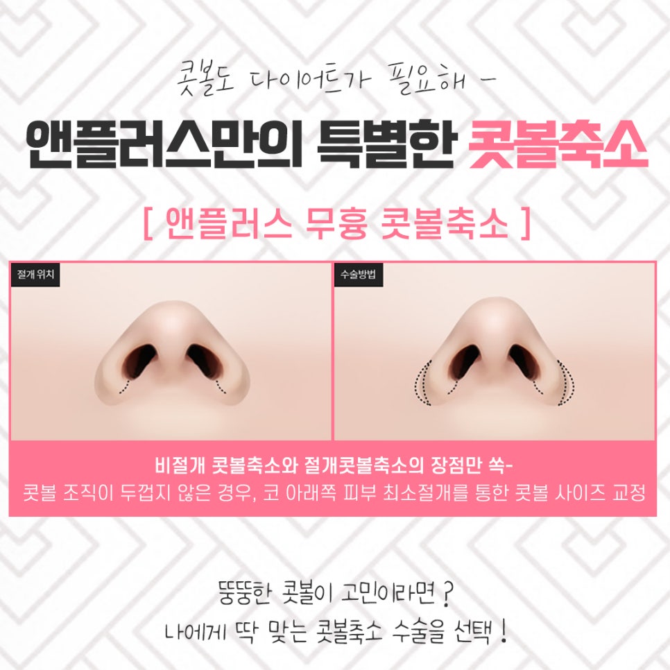콧볼축소후기 넓은 콧볼이 고민이라면 관련 이미지 8