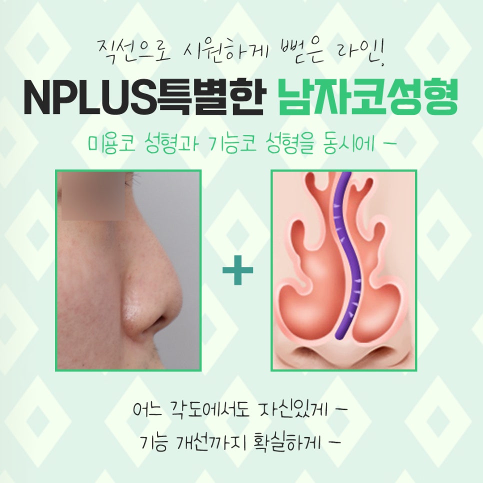 Learn About Before and After Male Nose Surgery in Various Ways image 4
