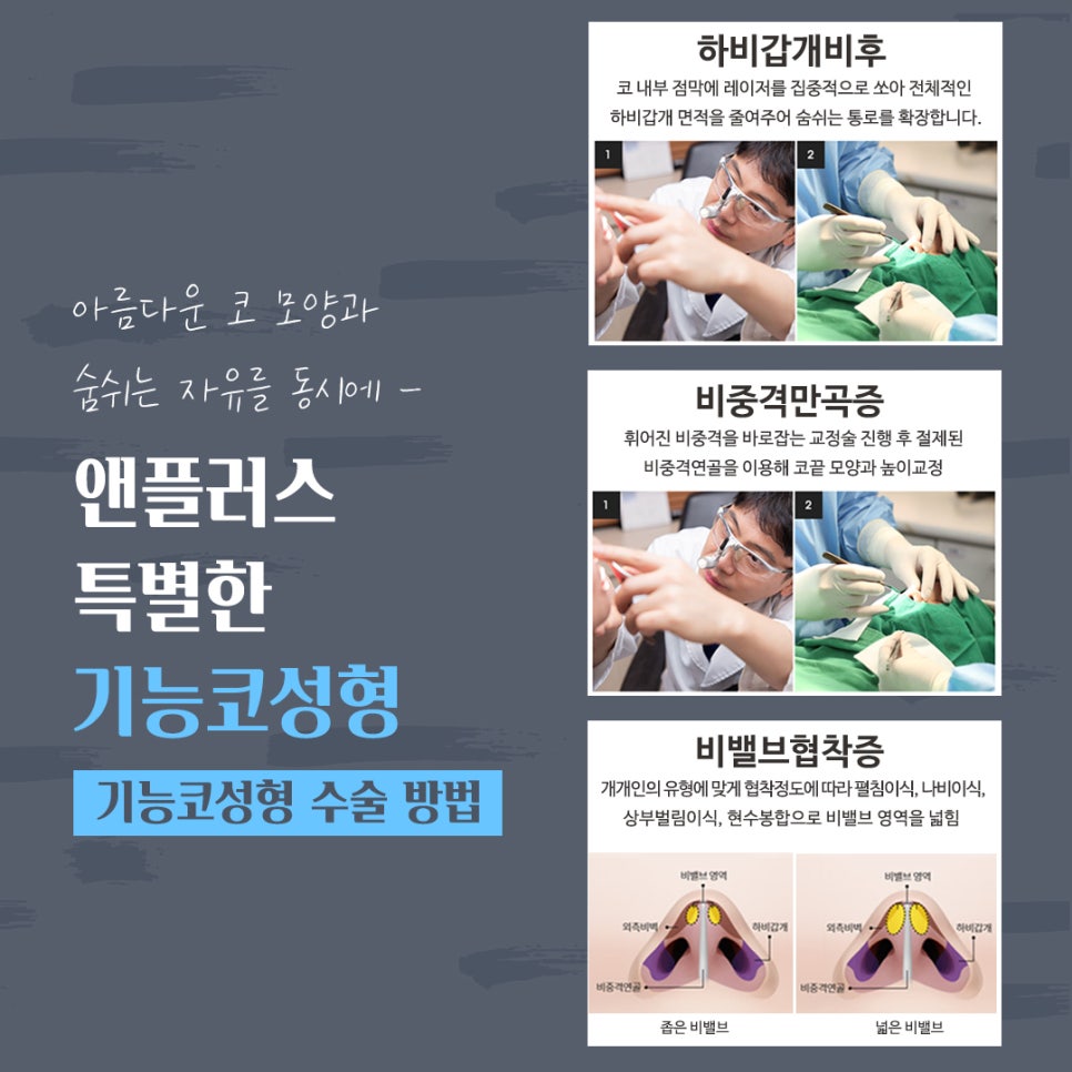 Rhinoplasty Review That Also Improved Function image 8