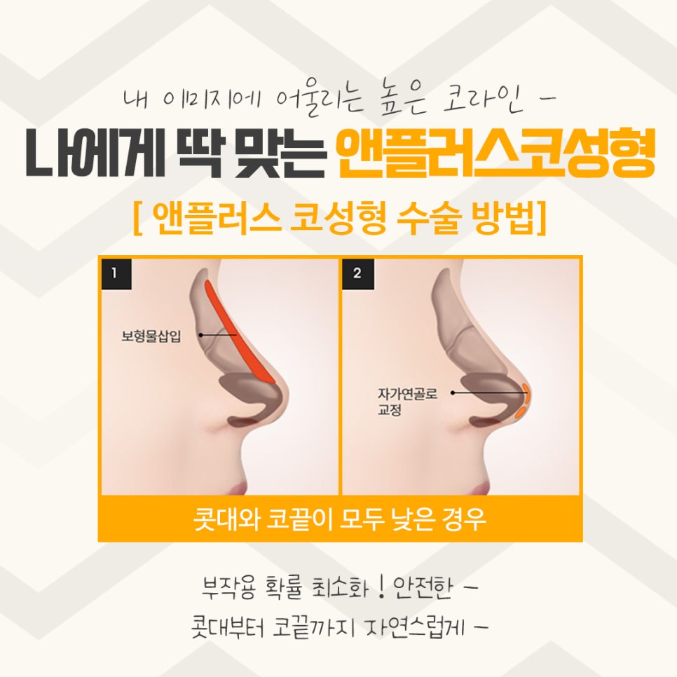 Understanding the Differences in Apgujeong Nose Surgery image 7