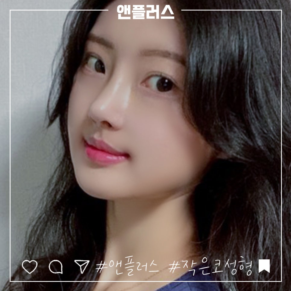 작은코수술 오지코병원에서 확실하게 확인해 보고 관련 이미지 5