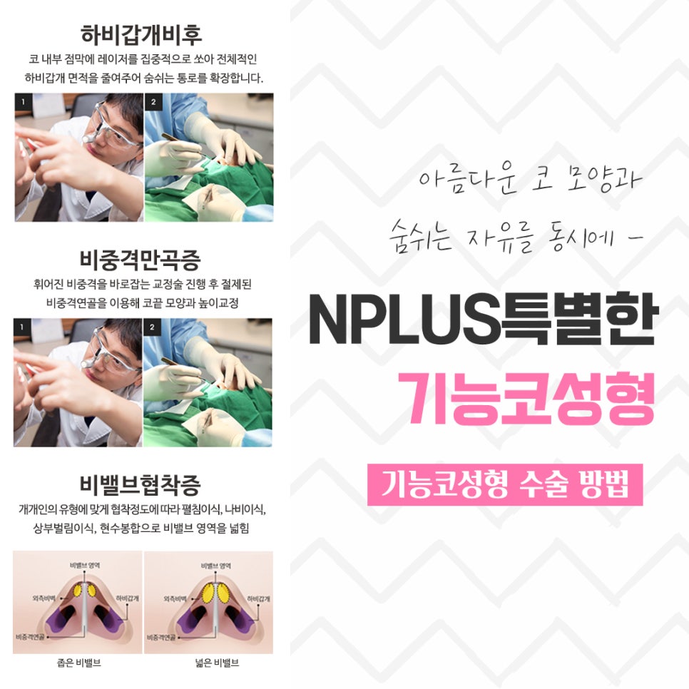 기능코수술후기 정확한 진단을 통해 관련 이미지 10