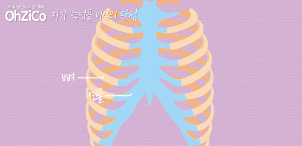 Pros and Cons of Autologous Rib Cartilage and Donor Rib Cartilage! image 16
