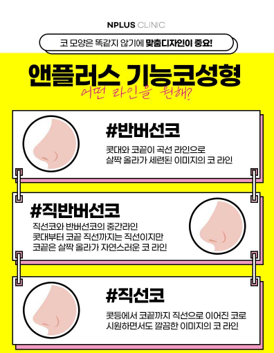 앤플러스에서 진행하는 기능코성형 EVENT 관련 이미지 3