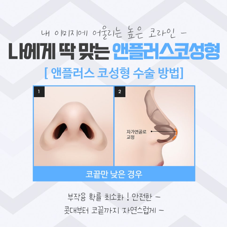 코성형후기를 다양하게 찾아보고 관련 이미지 10