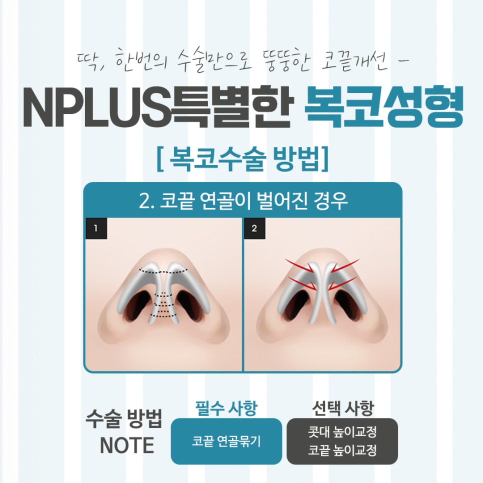 Looking Closely at Bulbous Nose Surgery Reviews image 9