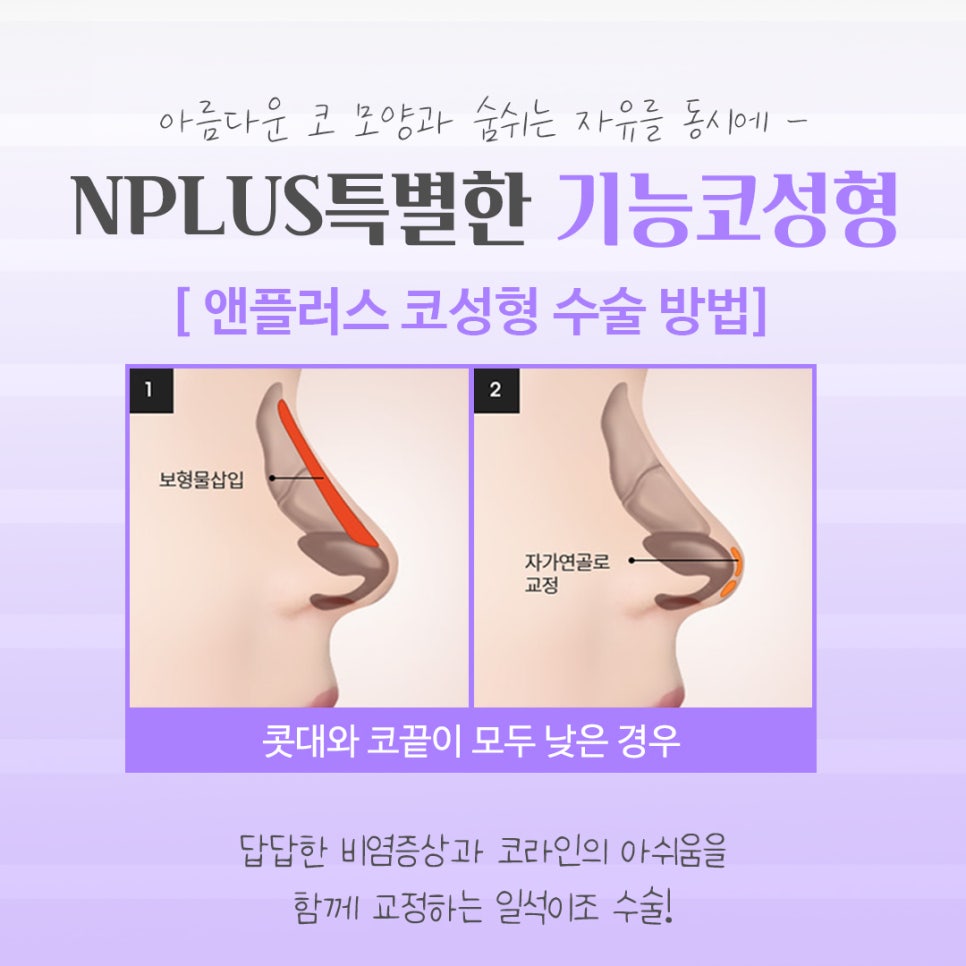 기능코성형후기에 대한 체크리스트 관련 이미지 10
