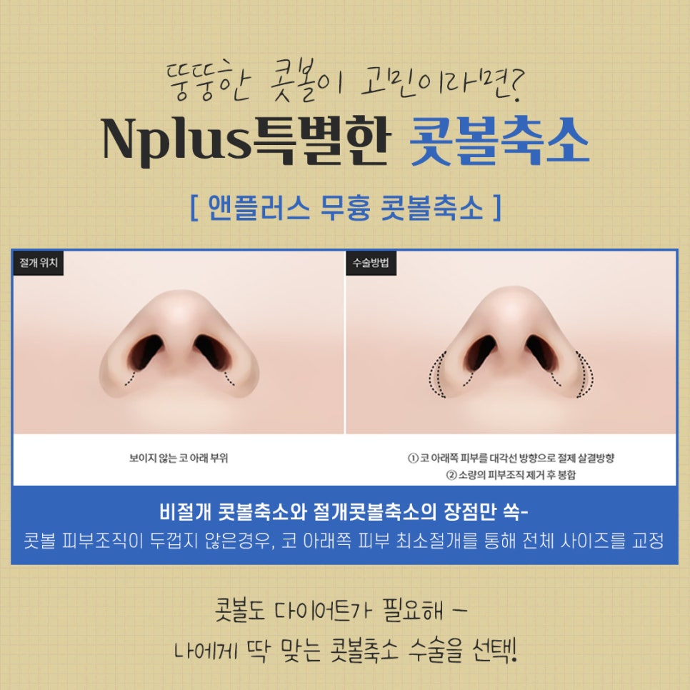Review of Nostril Reduction to Improve a Wide Nose image 6