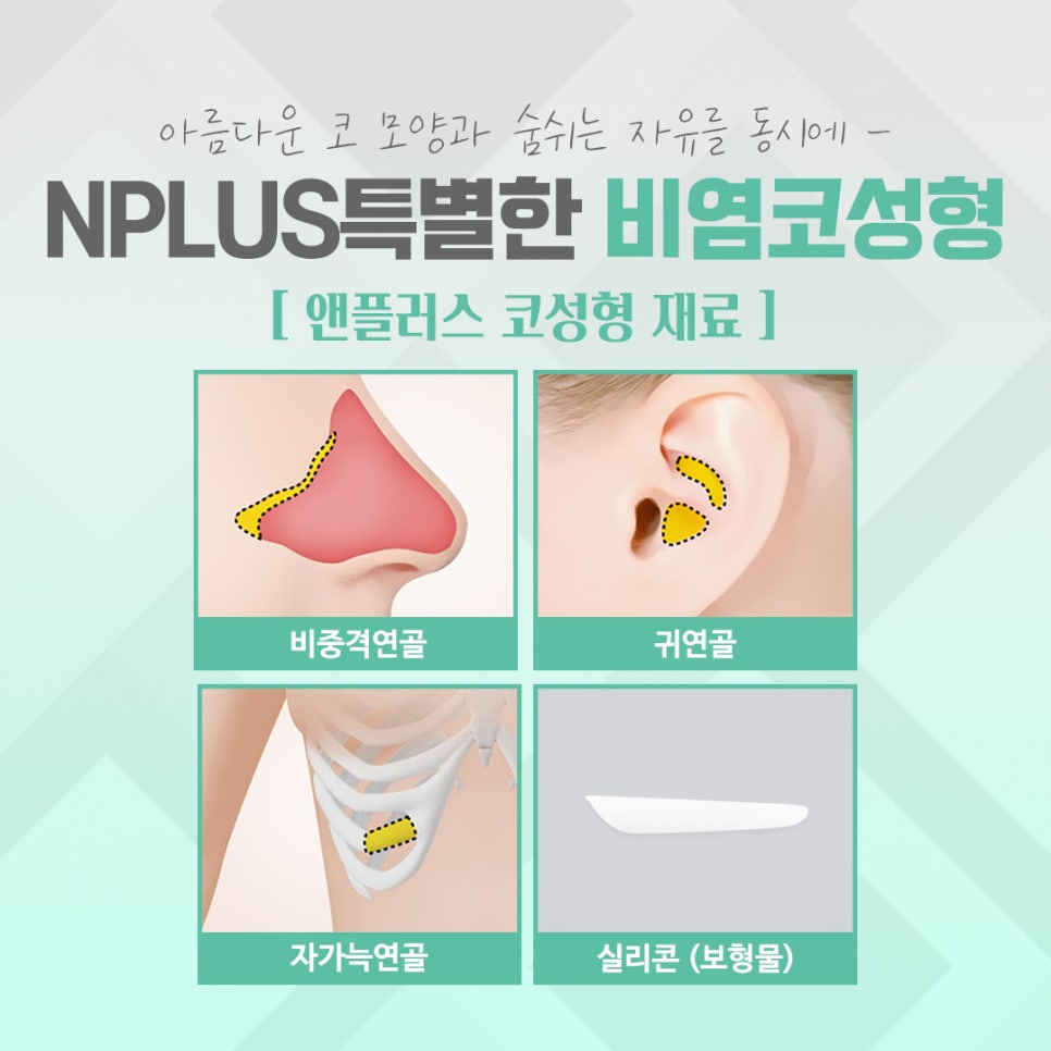 비염수술 내부 진단을 통해 관련 이미지 9