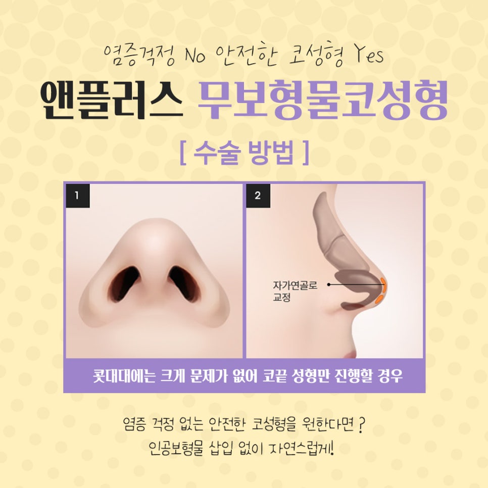 The Importance of Choosing Implant-Free Rhinoplasty image 9