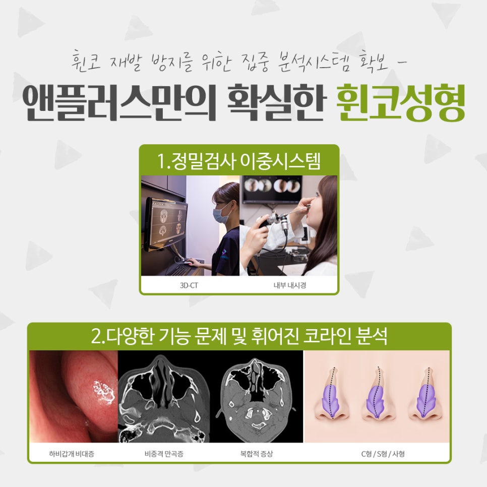 Whistling Nose Surgery Review: A Natural and Beautiful Line image 5