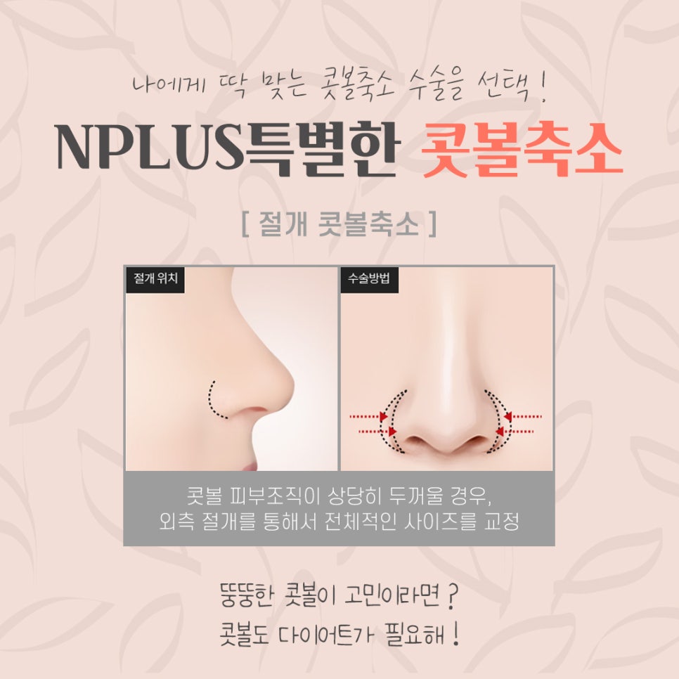 A Review of Nostril Reduction Surgery for a More Refined Look image 9