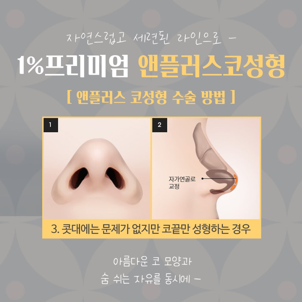 자가늑연골코수술 세련된 이미지로 관련 이미지 11
