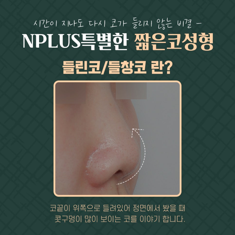 들린코수술로 이미지 개선 관련 이미지 4