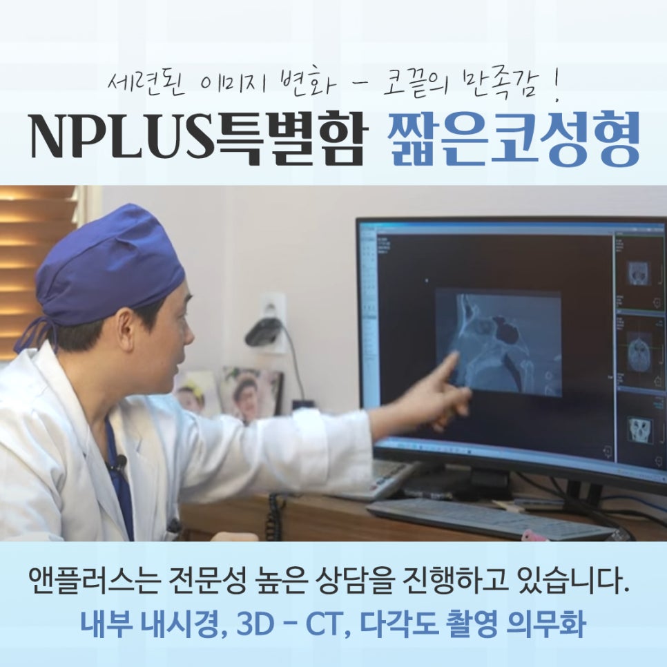 Short Nose Surgery for a Harmonious Line image 5