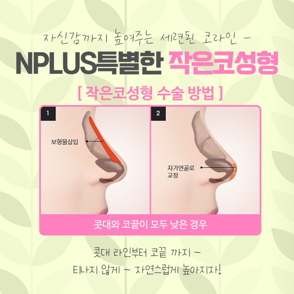 작은코수술 오지코병원에서 확실하게 확인해 보고 관련 이미지 9