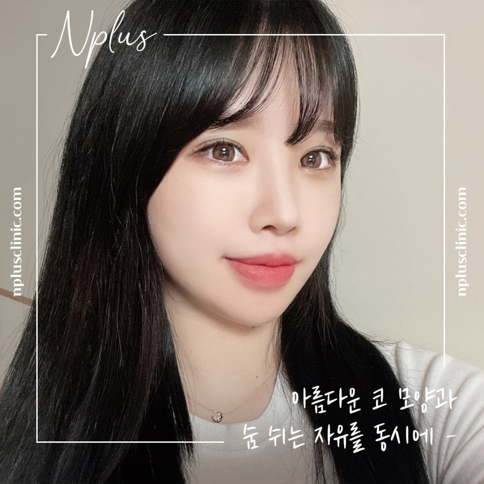 자가늑연골코성형으로 자연스럽지만 화려한 코 라인! 관련 이미지 11