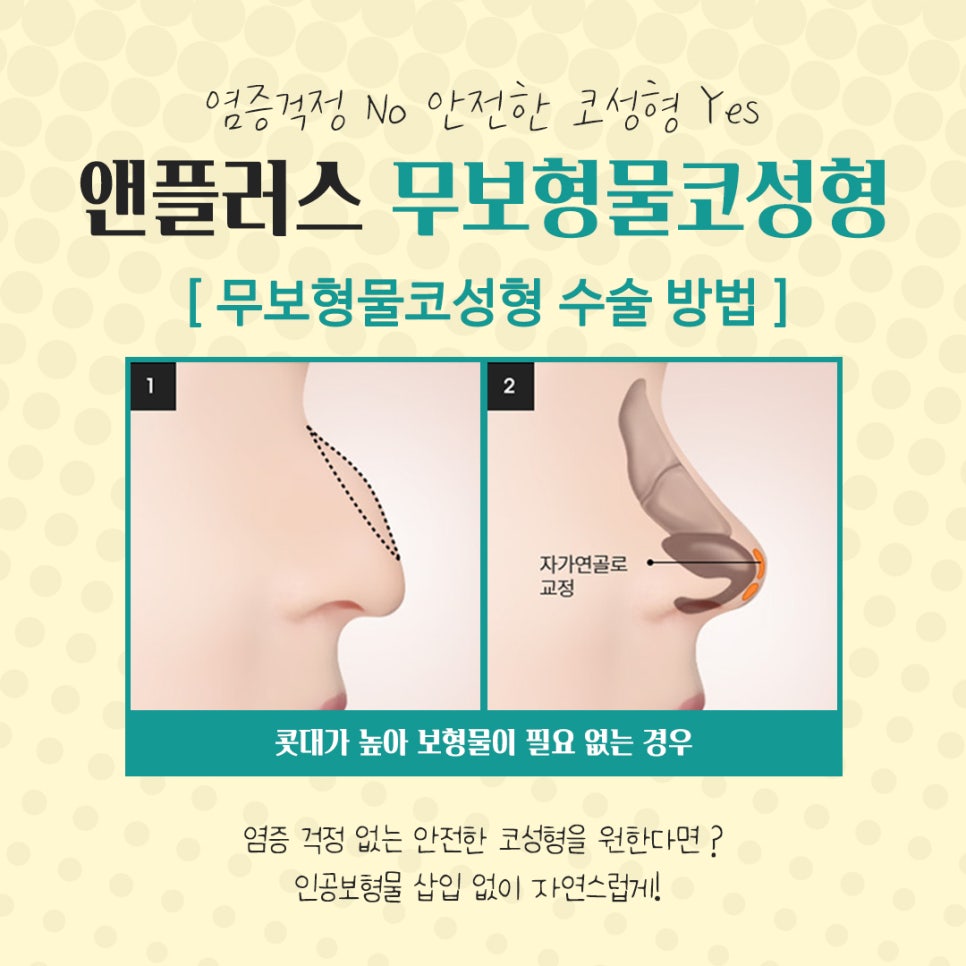 Natural Image Improvement with Non-Implant Nose Surgery image 7