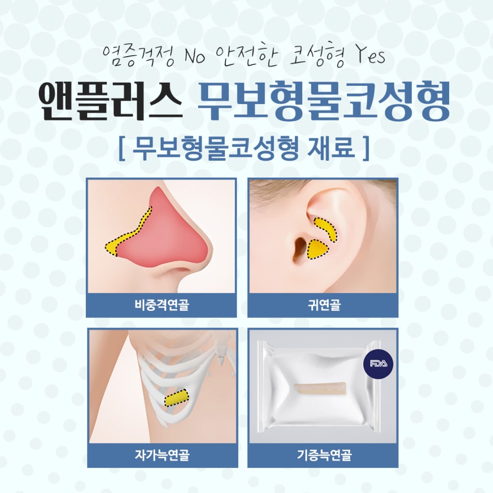무보형물코수술을 통해 자연스러운 코라인으로 관련 이미지 9