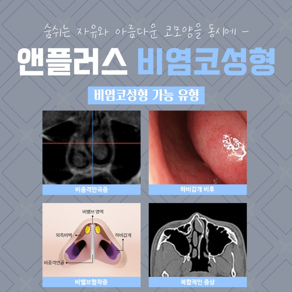 Nasal Correction Rhinoplasty Review: Identifying the Cause Properly image 4