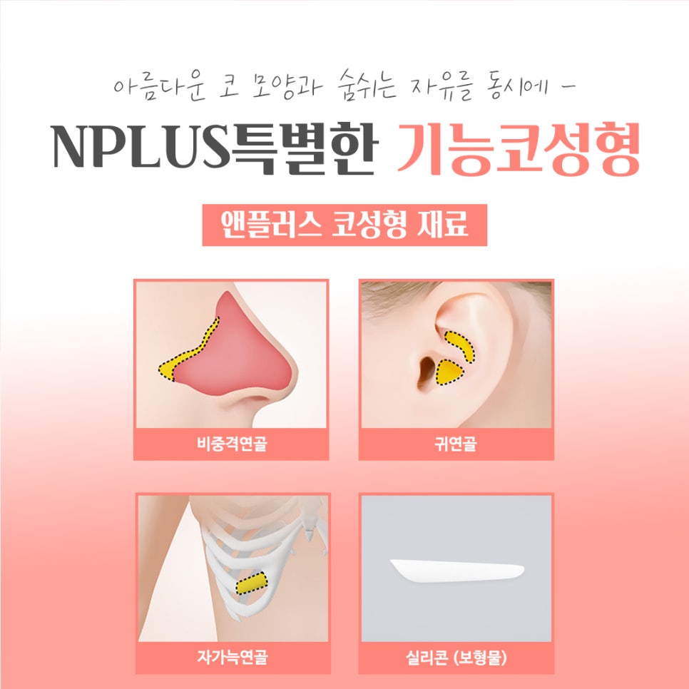 기능코성형후기 여러 가지를 비교하고 관련 이미지 11