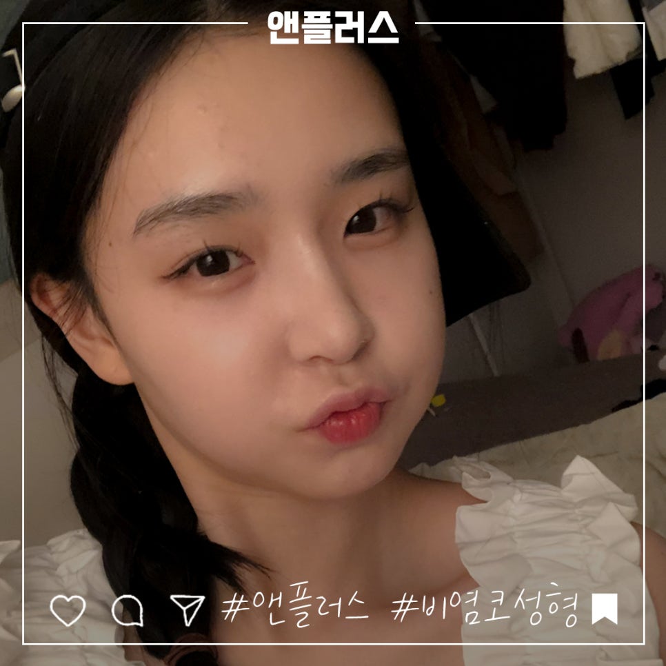 비염코수술전후에 대해 자세히 알아보고 관련 이미지 10