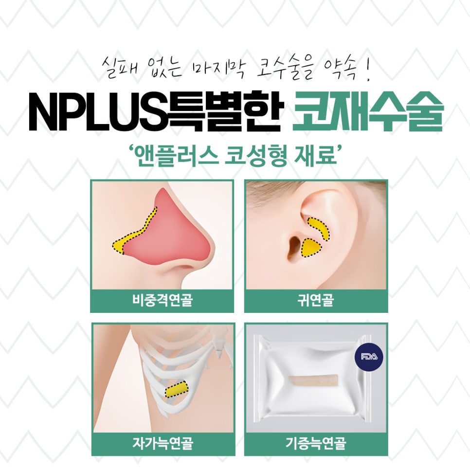 코재수술성형외과 신중하게 알아보고 관련 이미지 10