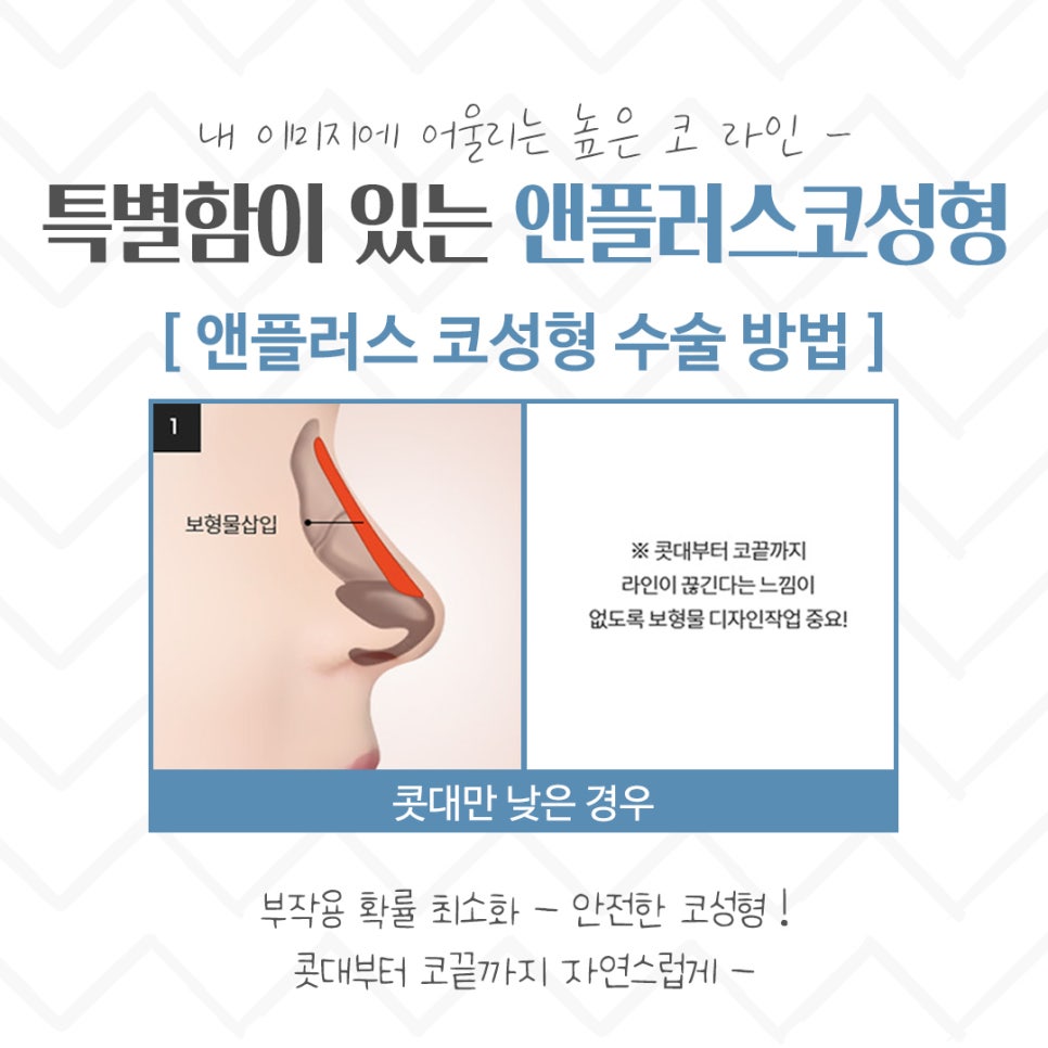Nose Surgery Review: A Thorough Look Inside image 9