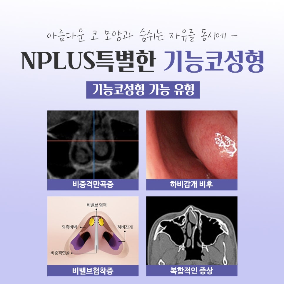 Check the Difference in Functional Nose Surgery Reviews image 5