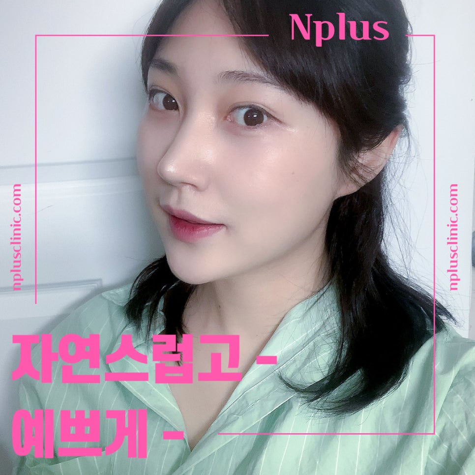 A Refined Look Through Female Hump Nose Surgery image 8