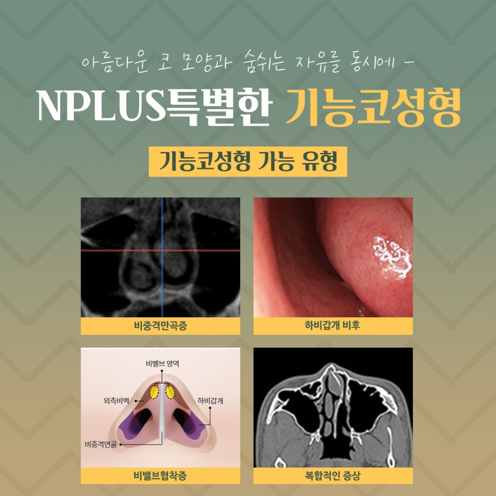 Making an Accurate Judgment About Functional Rhinoplasty Reviews image 4