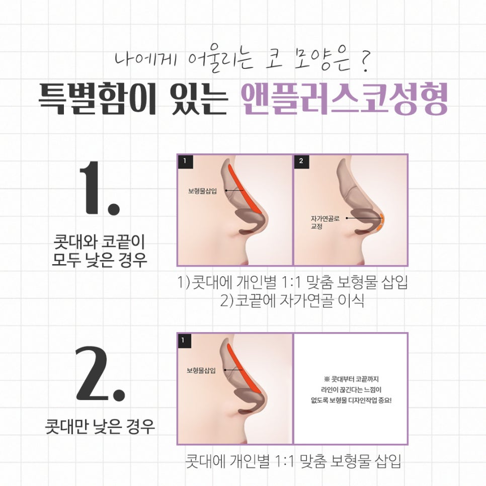 콧대수술 코 내부까지 정확하게 확인하고 관련 이미지 7