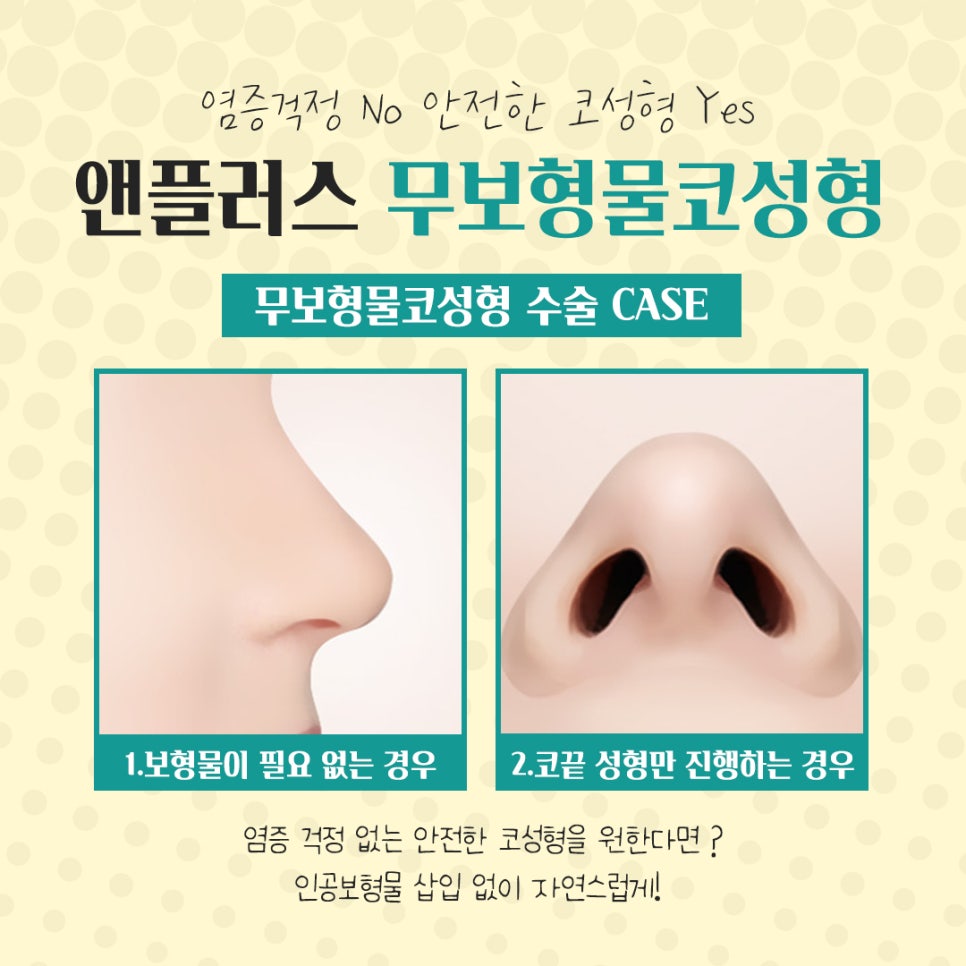 Natural Image Improvement with Non-Implant Nose Surgery image 6
