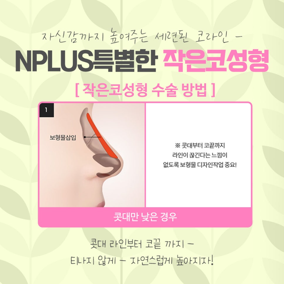 작은코수술 오지코병원에서 확실하게 확인해 보고 관련 이미지 10