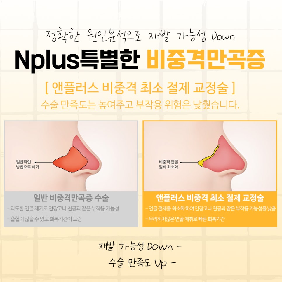 비중격만곡증수술후기에 대해 신중하게 찾아보고 관련 이미지 10