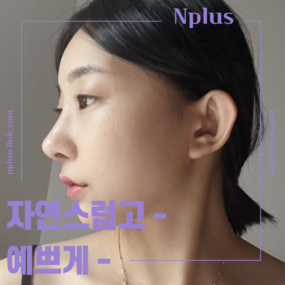 압구정코수술에 대해 찾아보고 관련 이미지 4