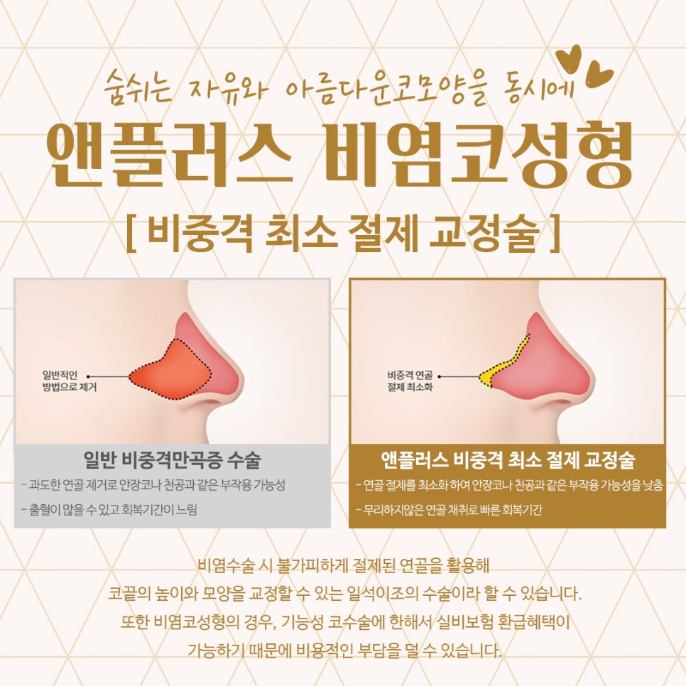 비염코성형후기 예쁜코라인을 생각하면서 관련 이미지 9