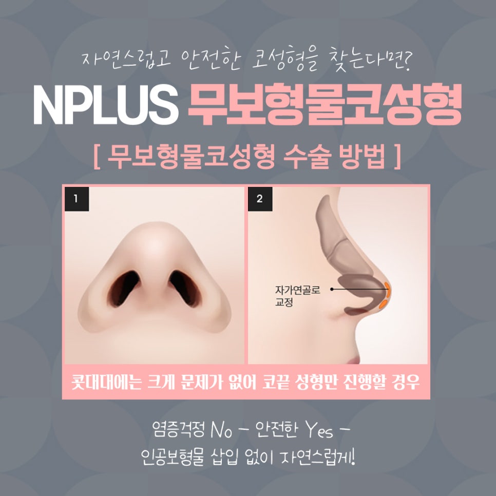 No-Implant Nose Surgery for a Natural Nose Line image 9